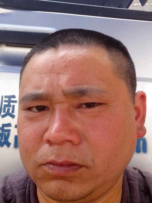 受伤的人