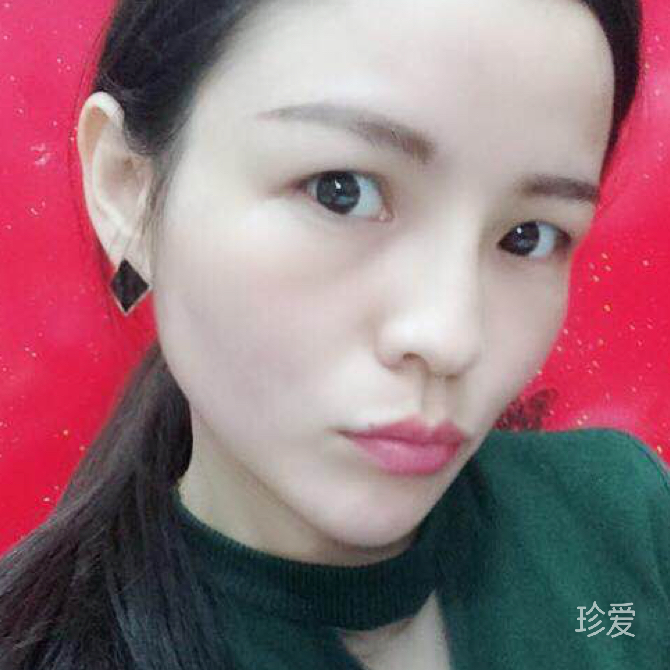 阿无瑞样样个