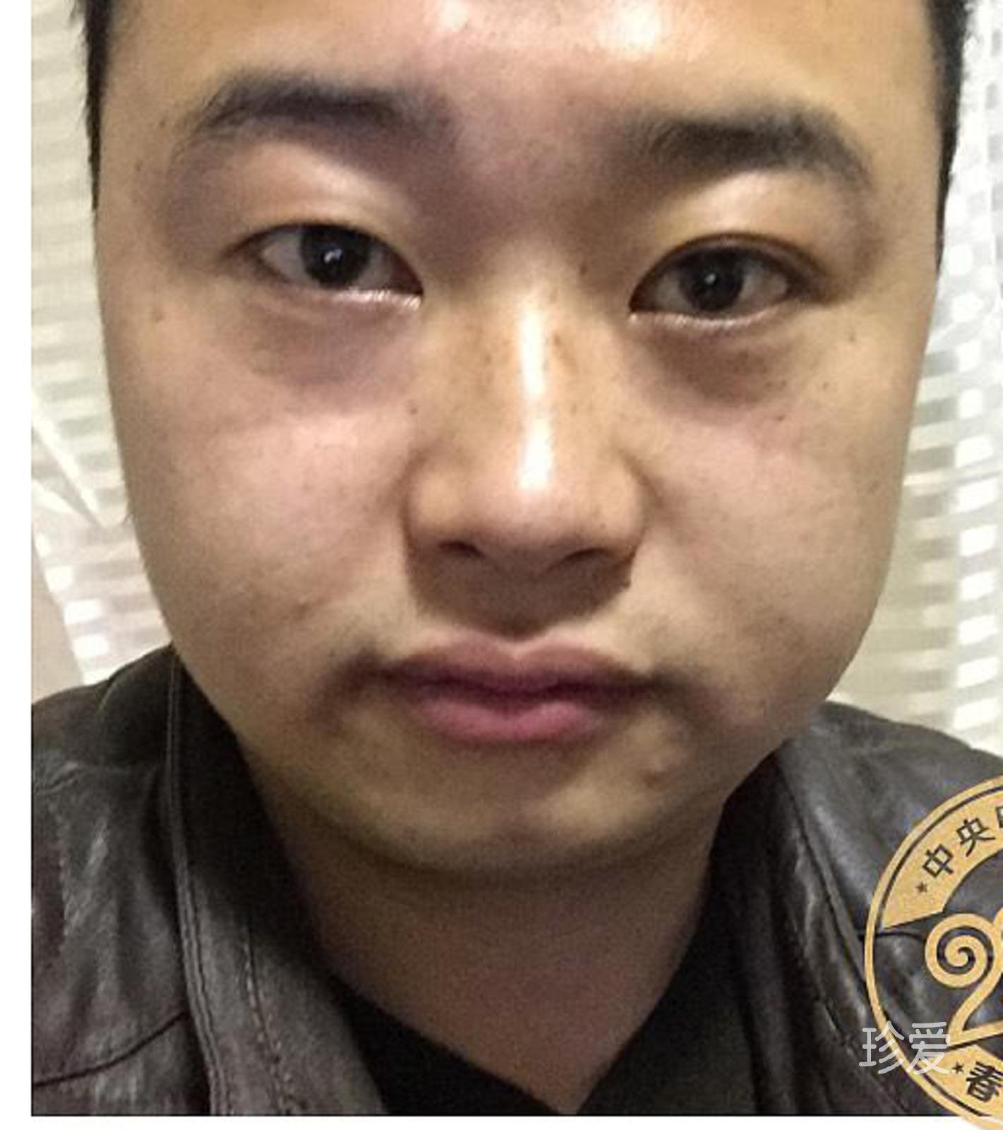 小薛