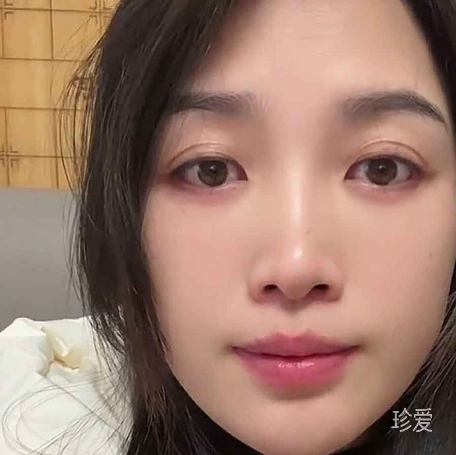 晓晨