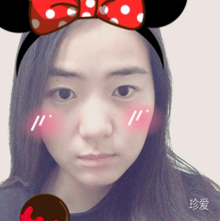 小胖