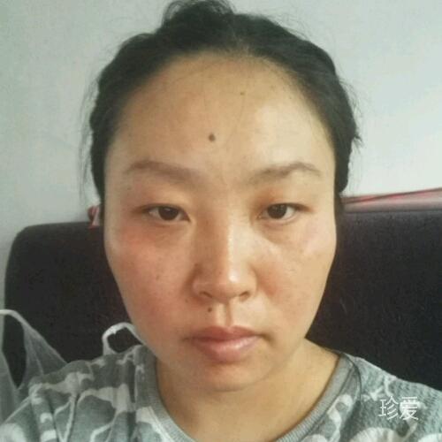小红鱼