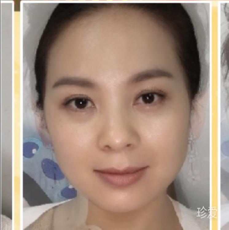 林林