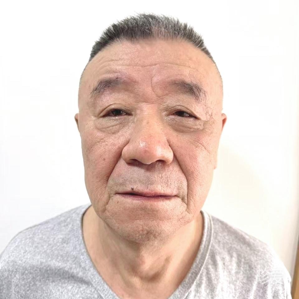 旭光