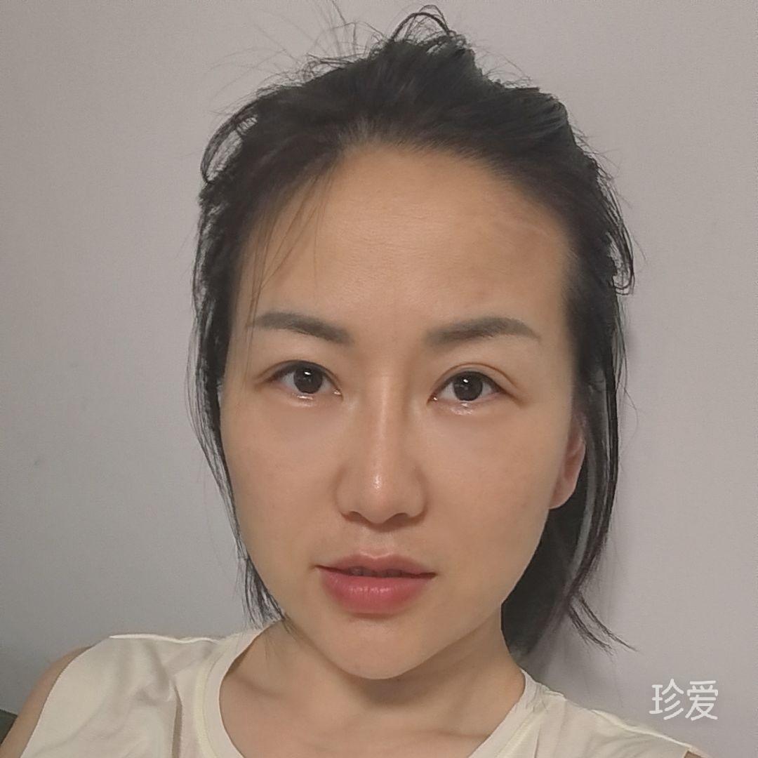 喜宝