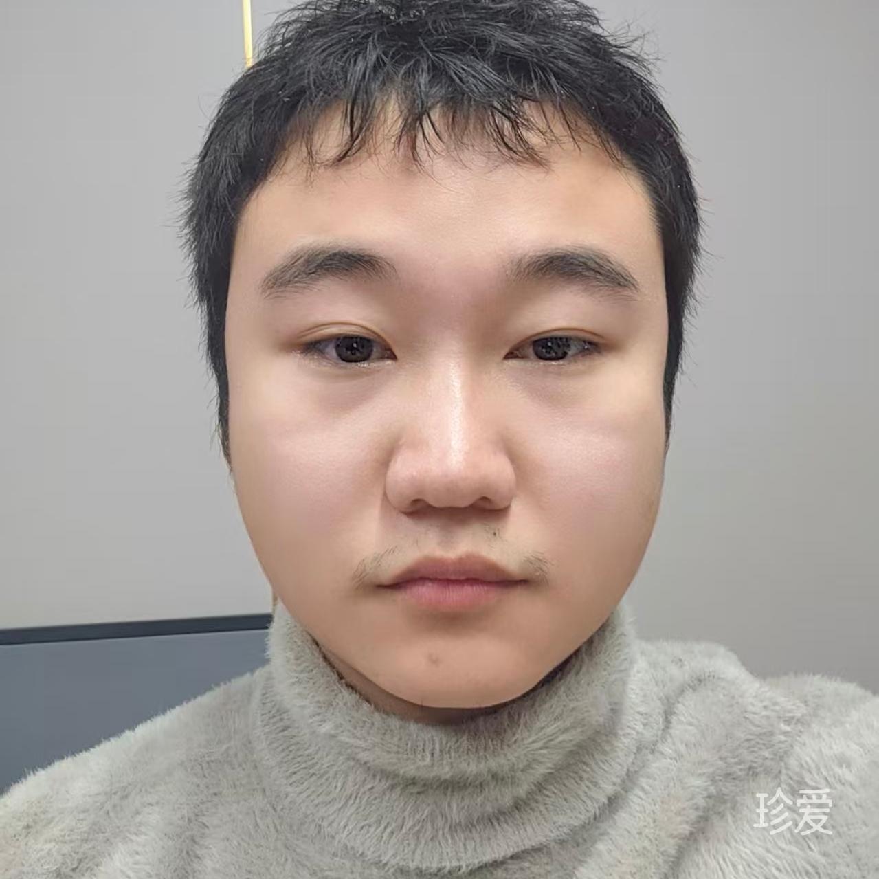 坦诚相待