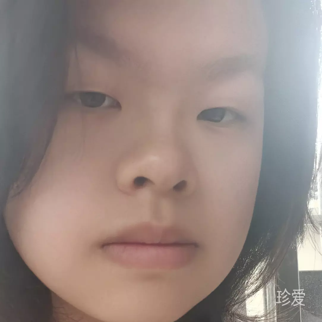 木白