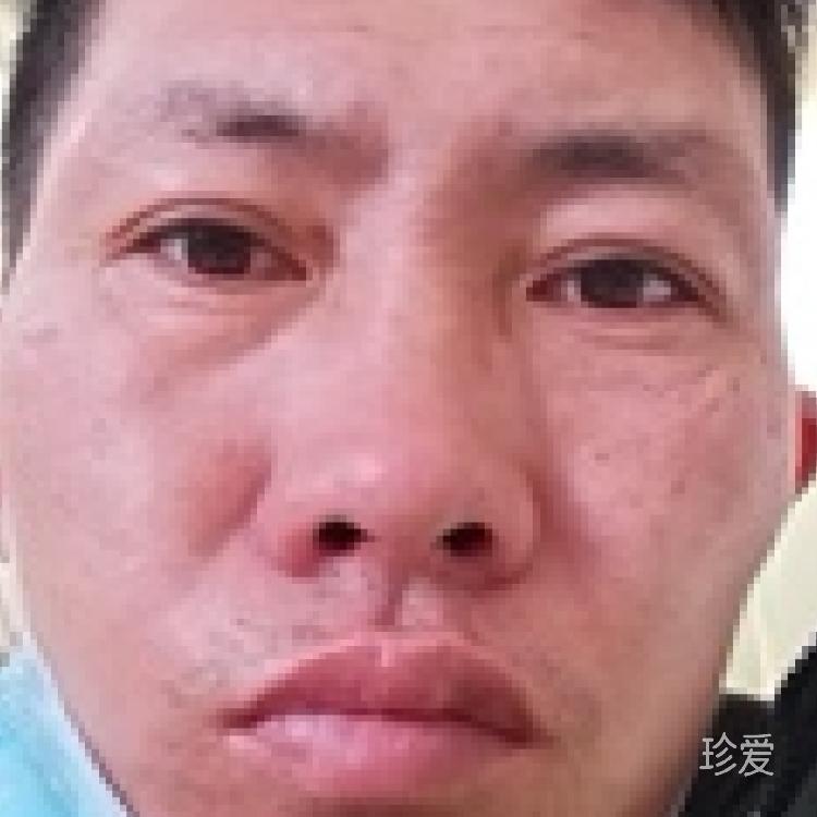 阿念