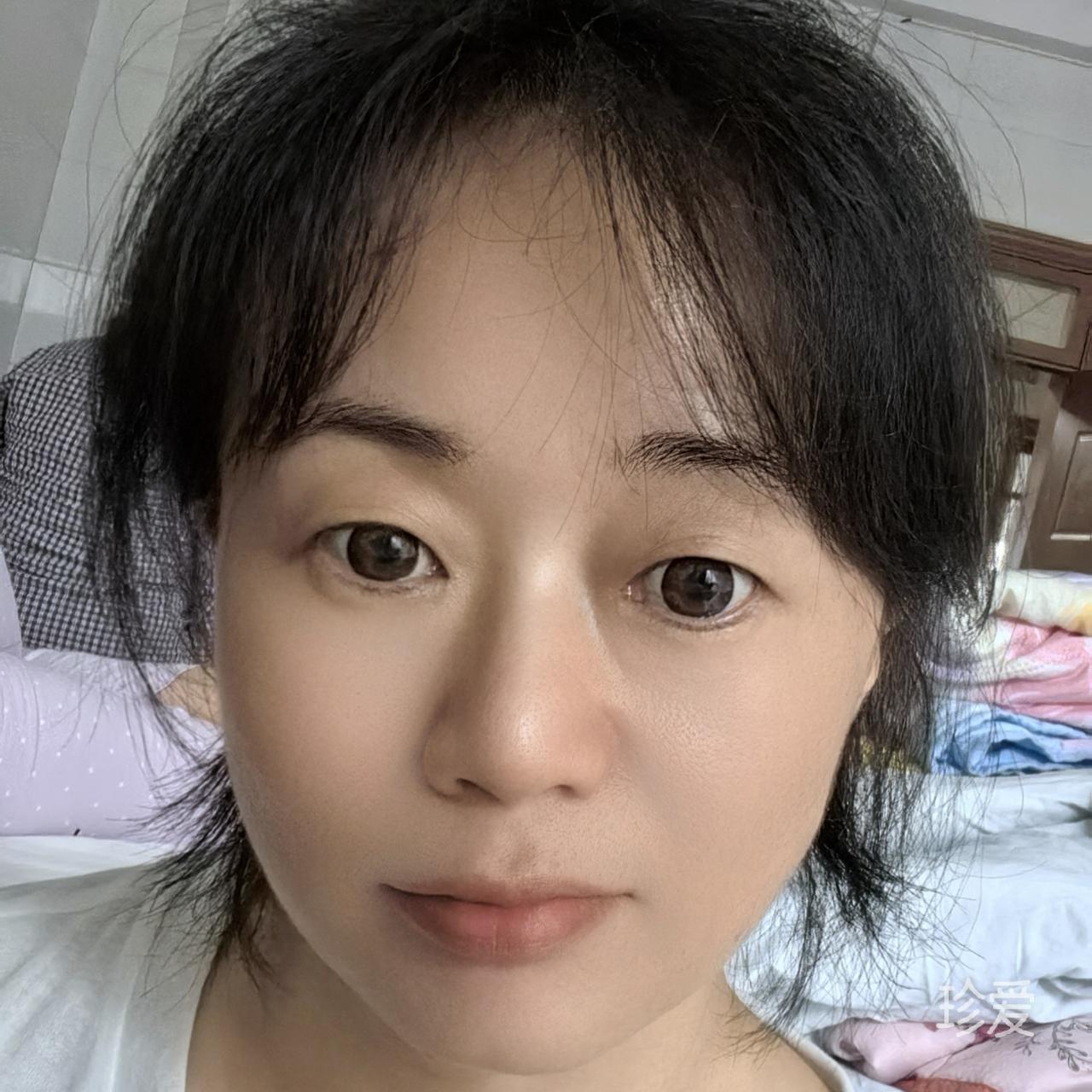 米阳