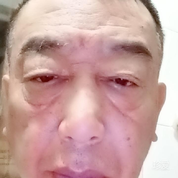 雨后看见彩