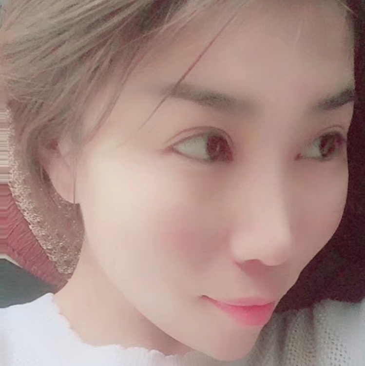 影子