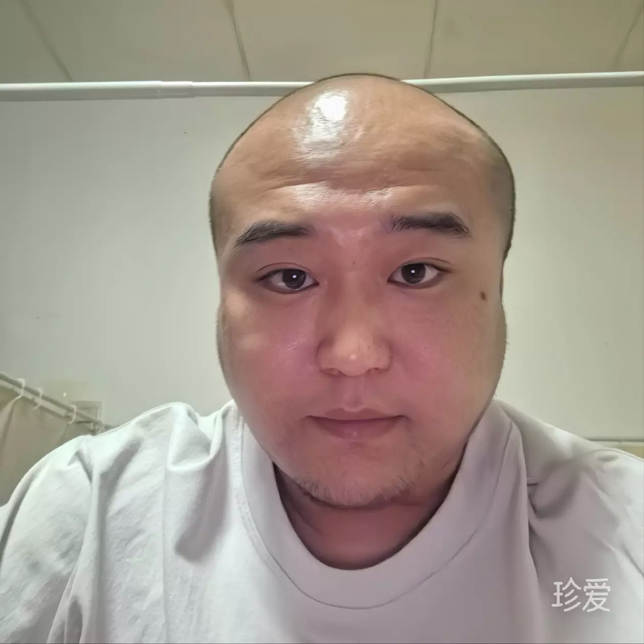 昨天之明天