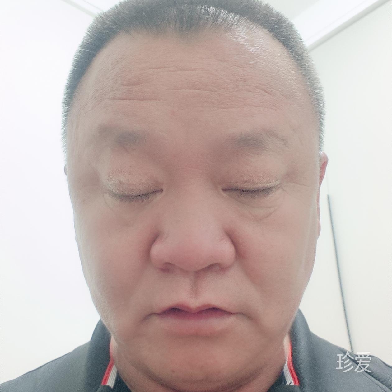 等待花开