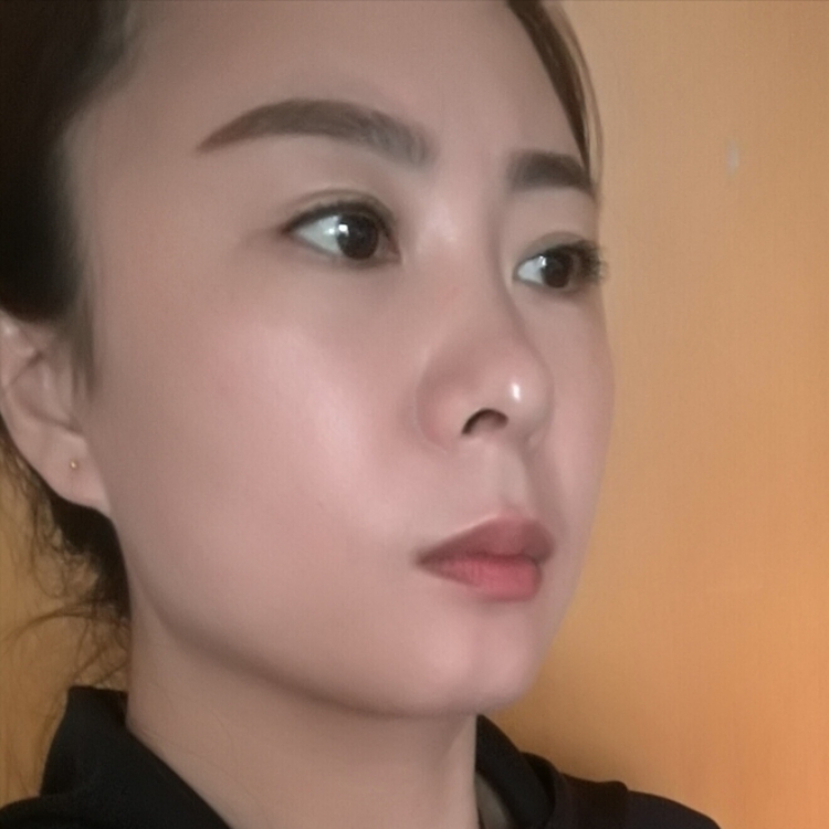 小艾