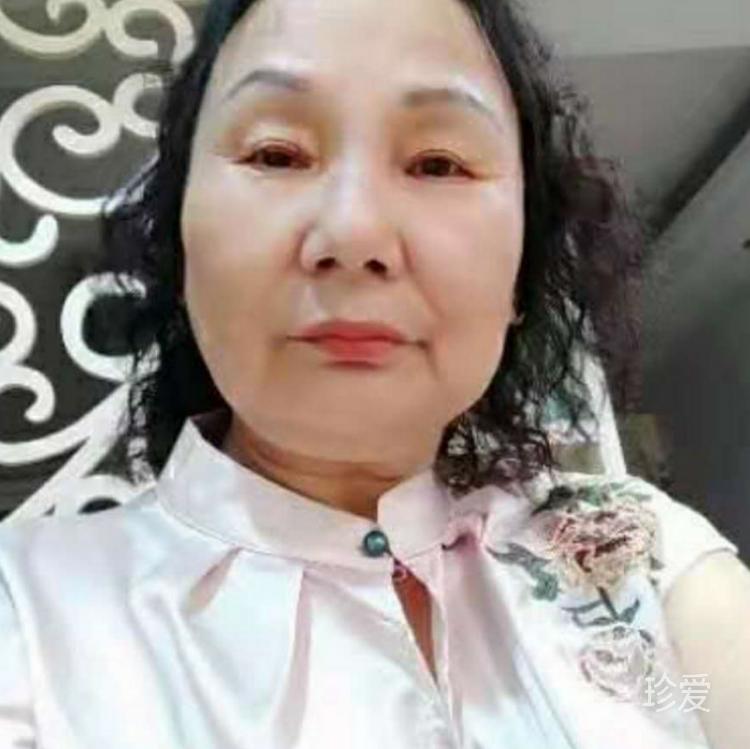 忆梦