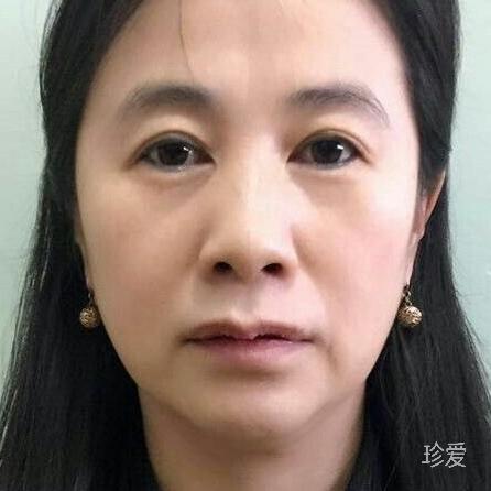 找寻失去的爱