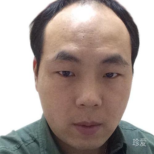 山的期待