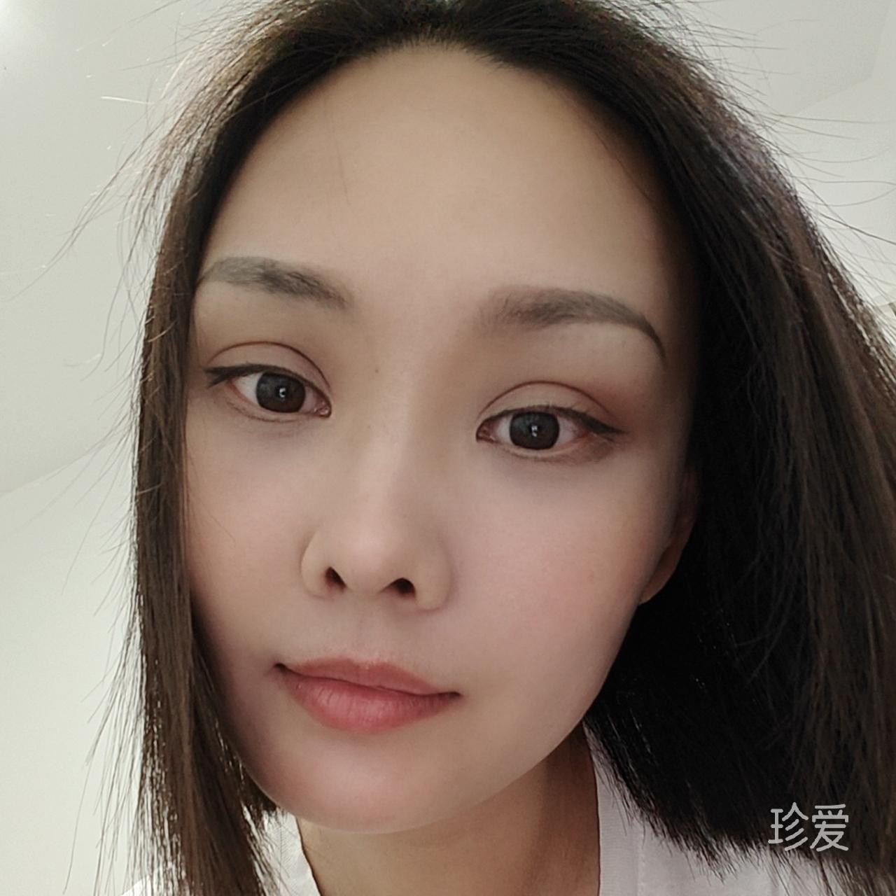 小霏