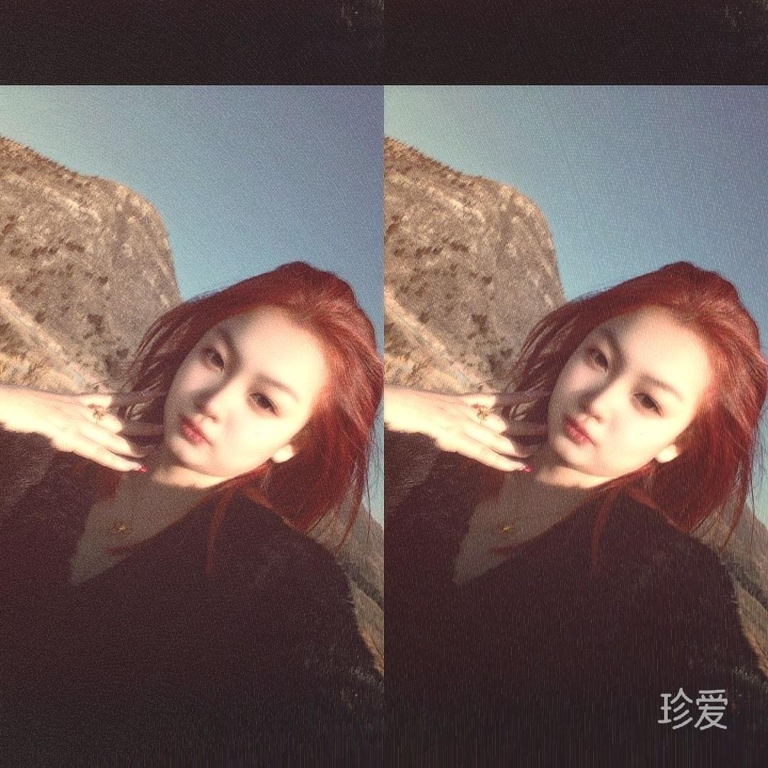 小宇