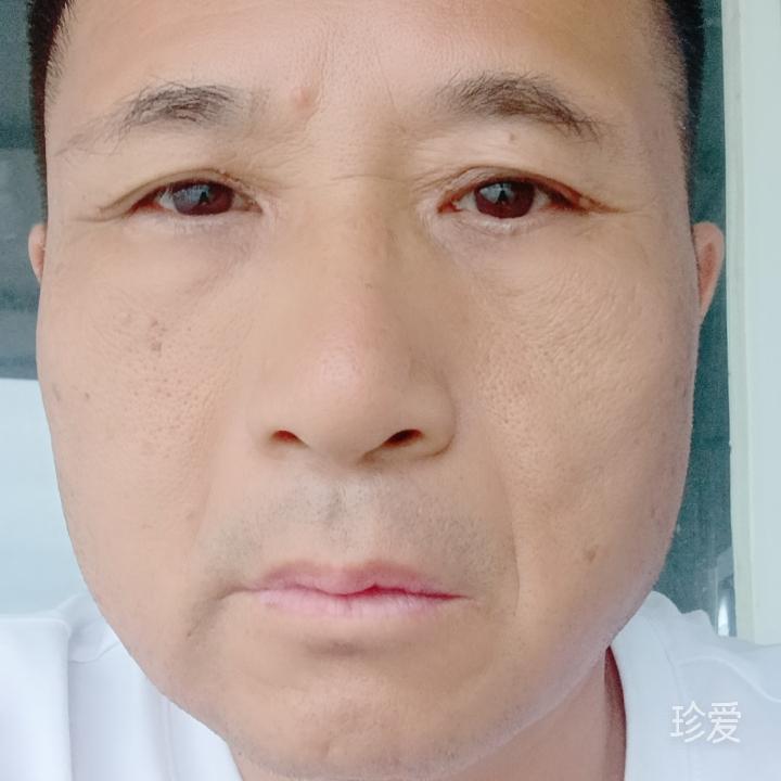 北极