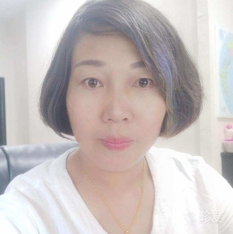 Amyfeng