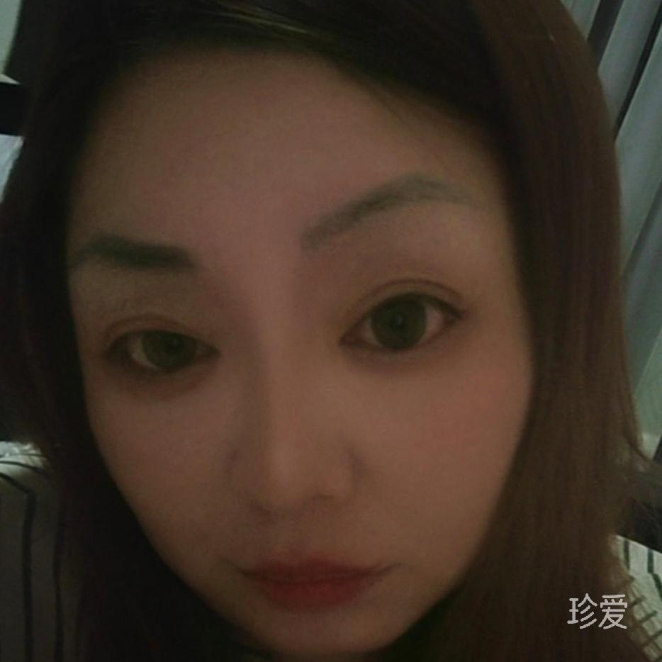 糖净静