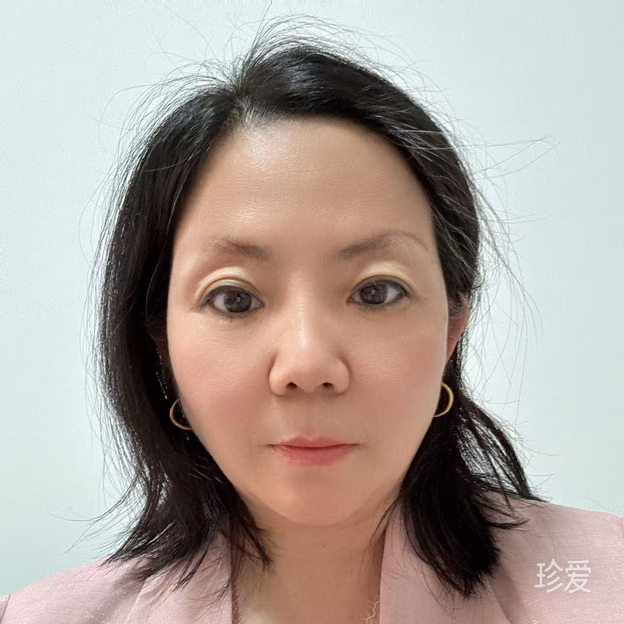安娜