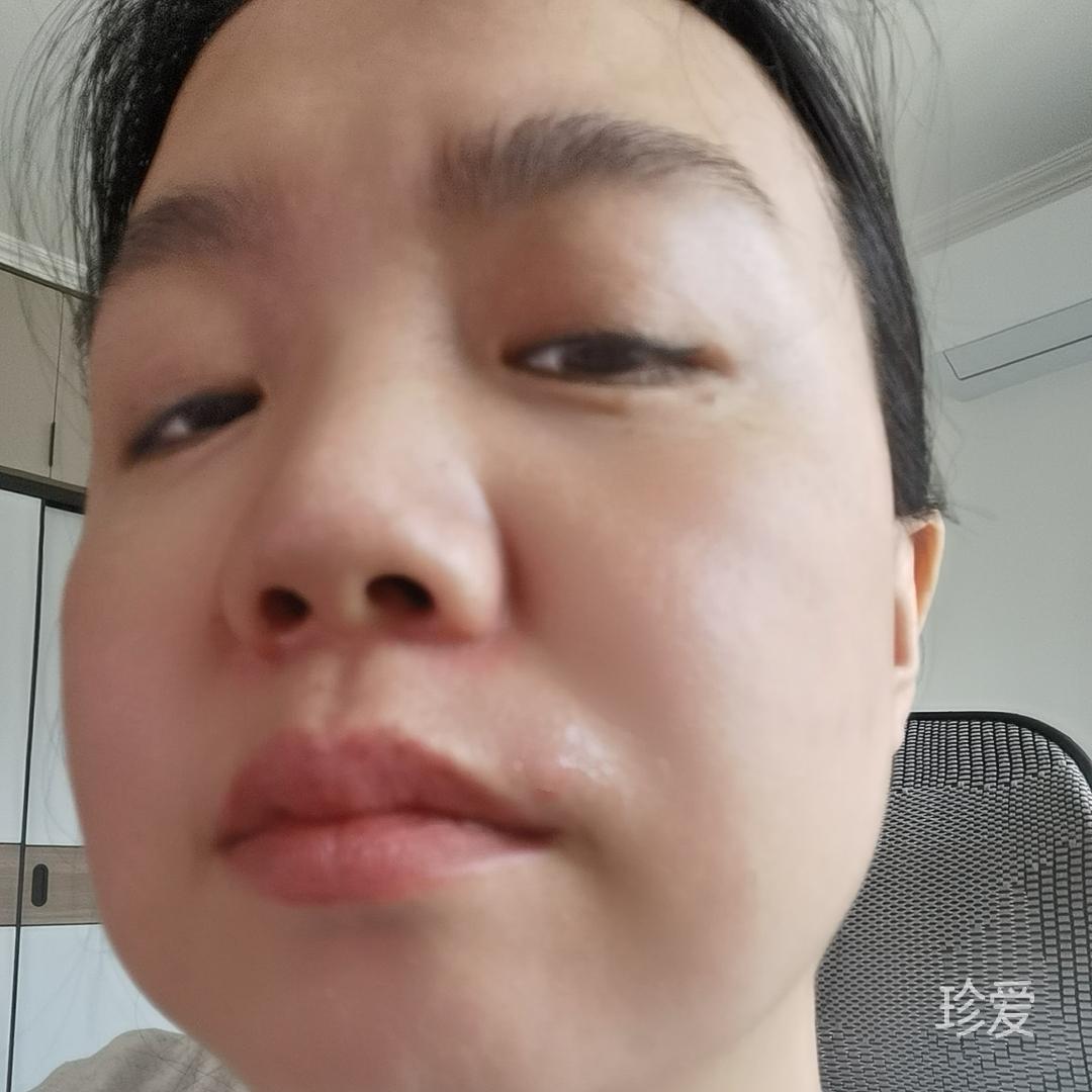 单个酒窝
