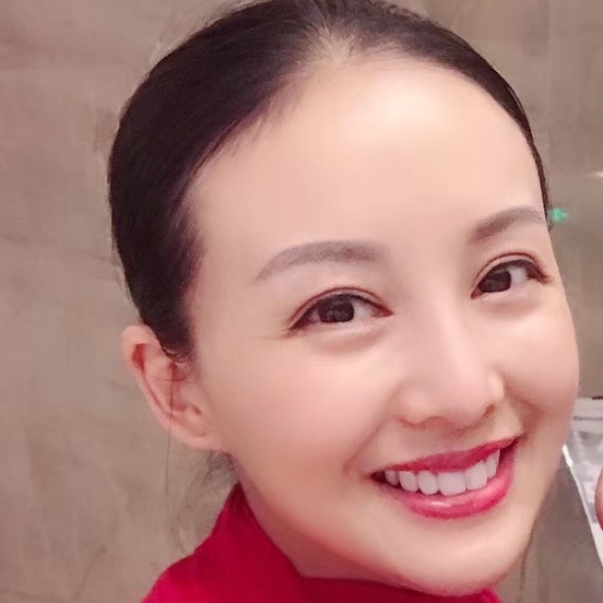 甯静惠远