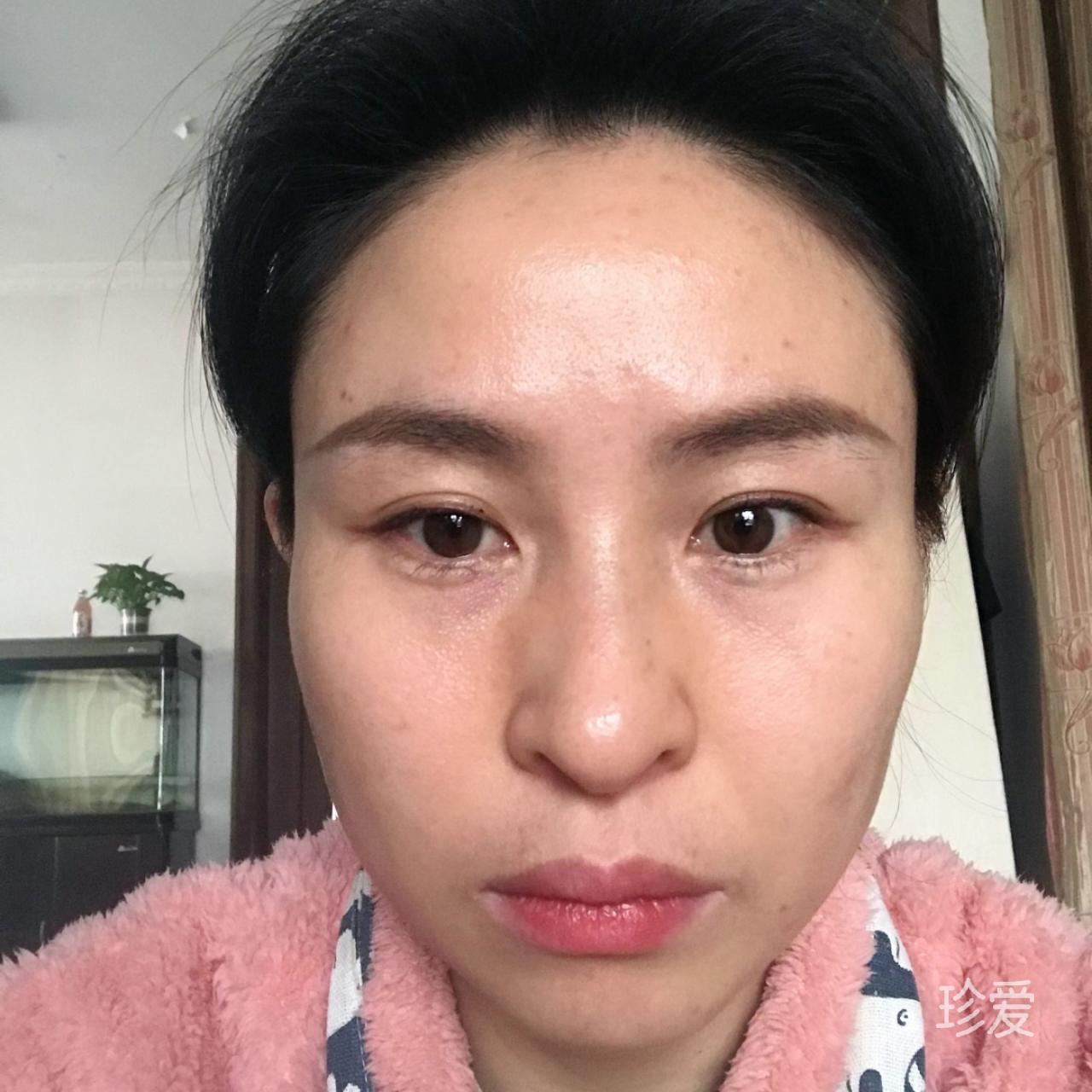 昭君