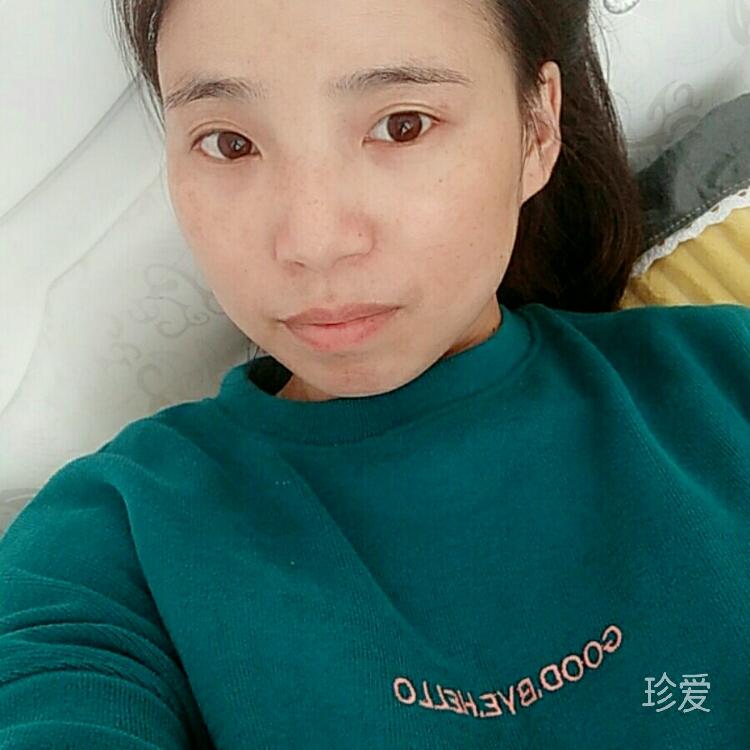 蓝狐