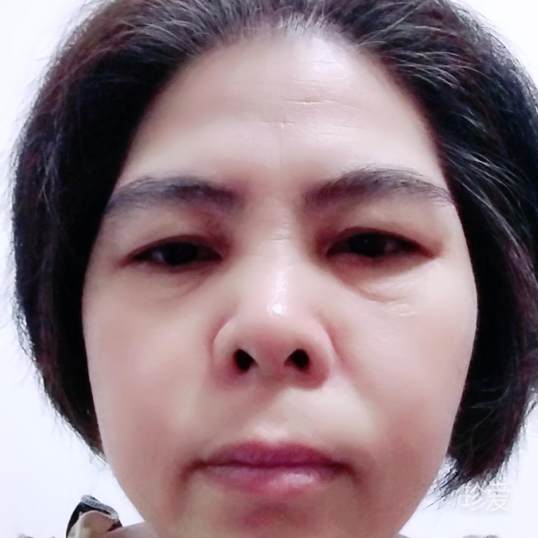 小巧玲珑