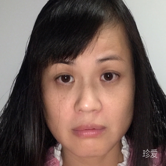 许多年以后