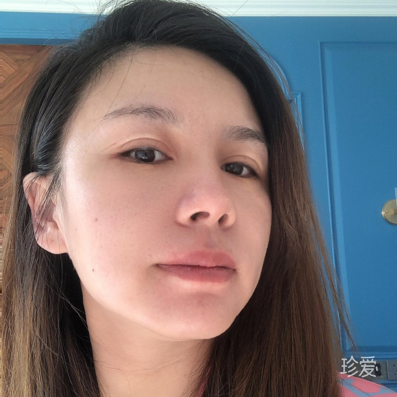 花笑人生也是呆