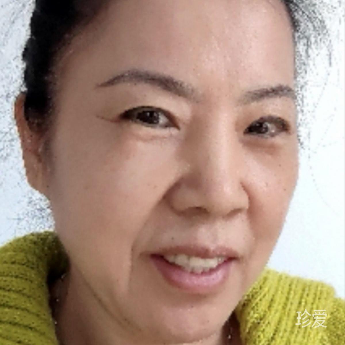 惠儿