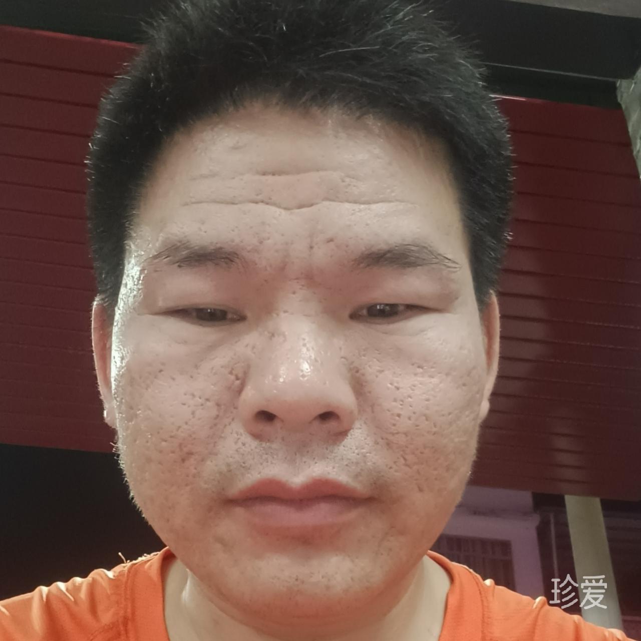 太阳