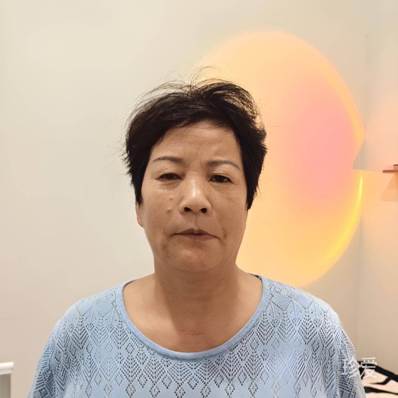 凤姐