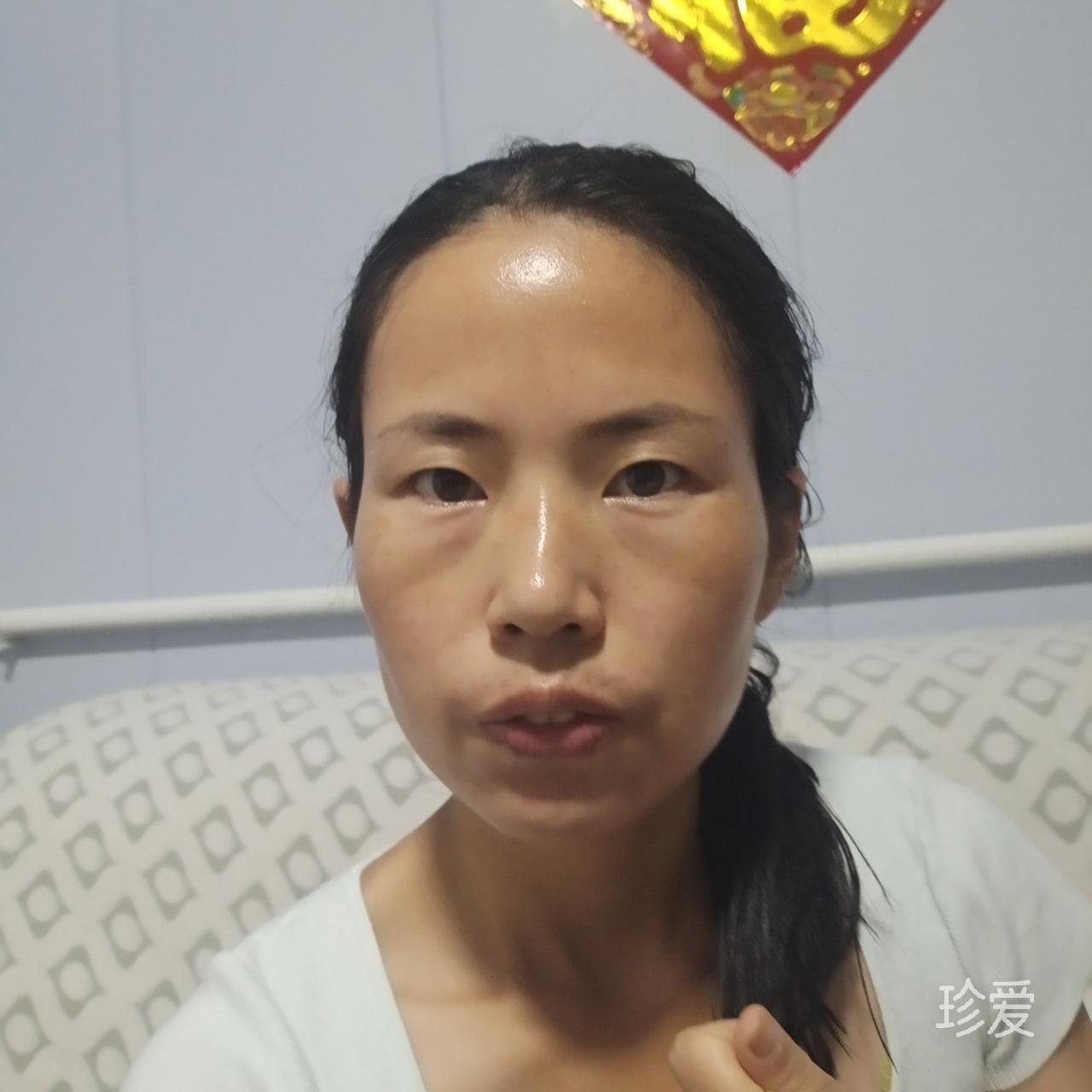 蜗牛