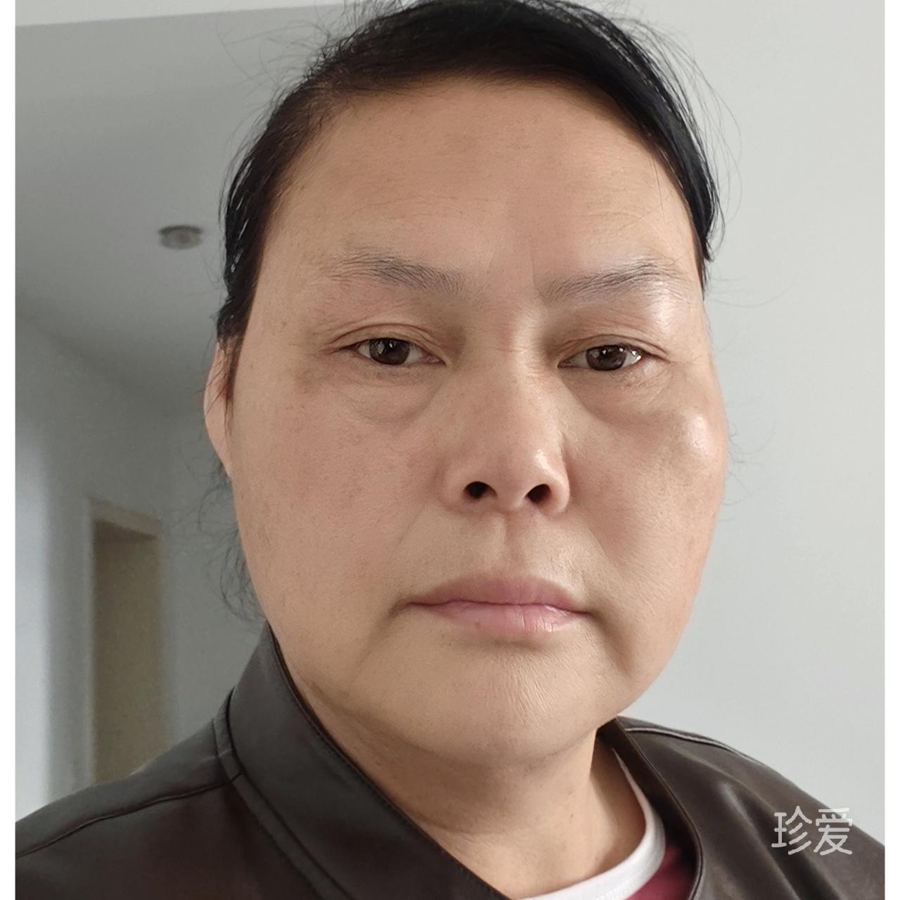 暖心