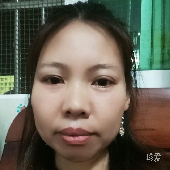 糖粒子