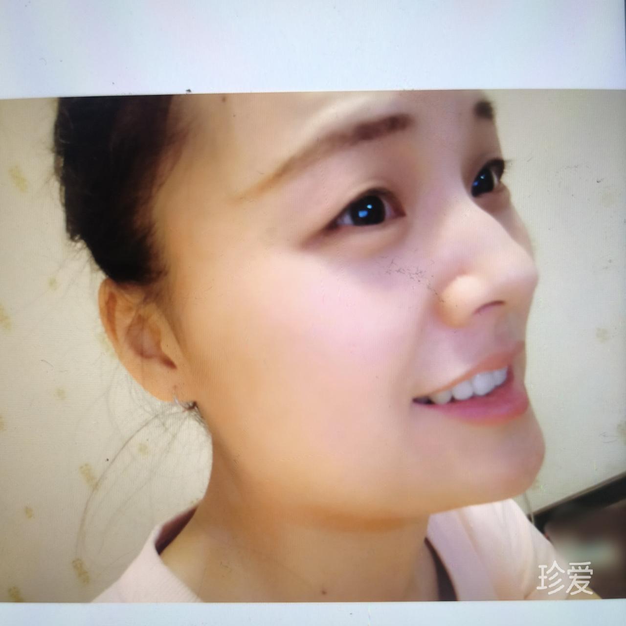 阳光