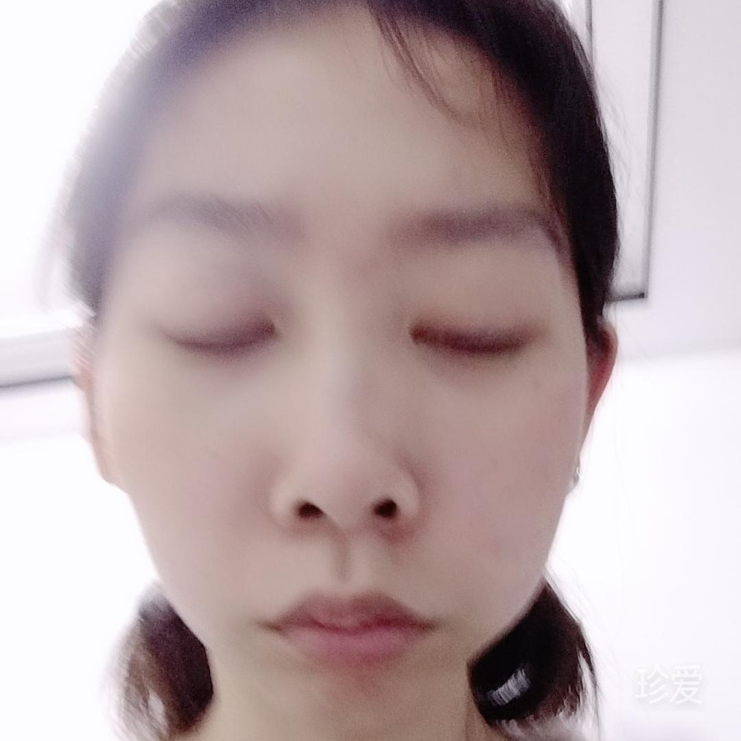 梦琦