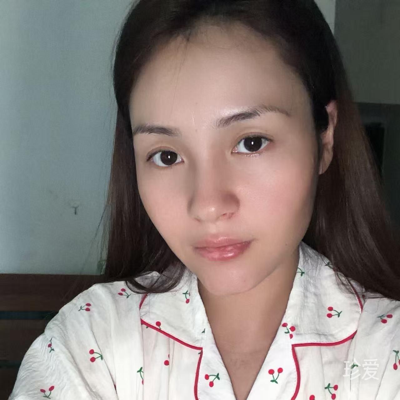 小鱼