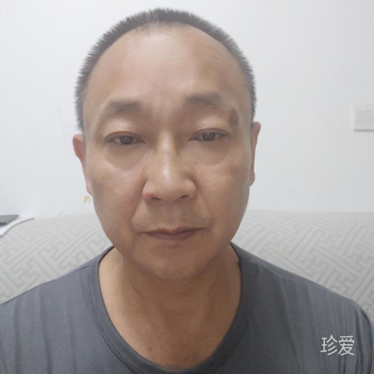 真心期待