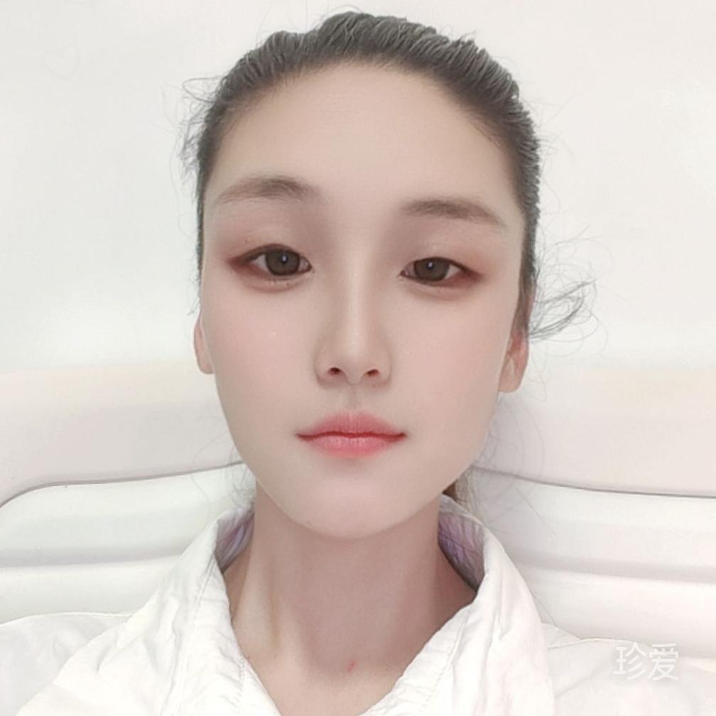 糖果