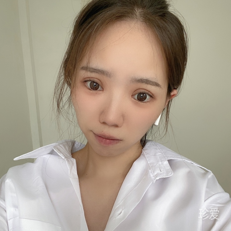 孤独患者