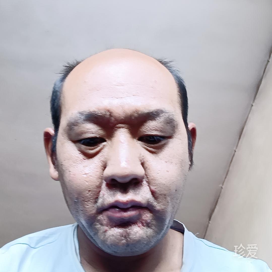 菲尼克斯