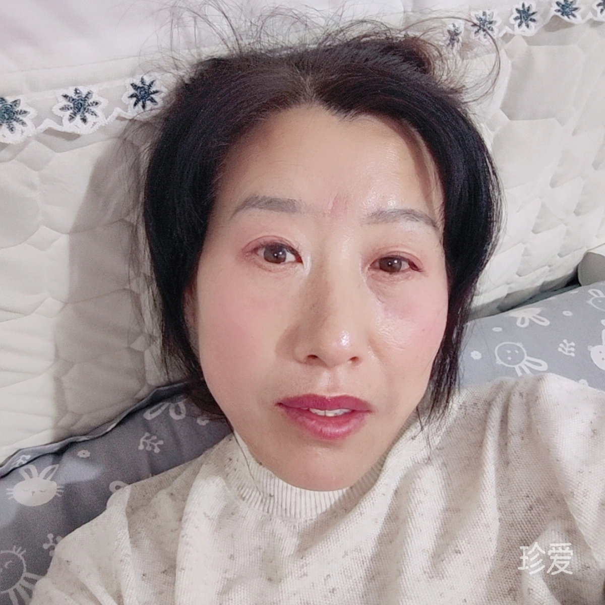 太阳刺眼旳光芒