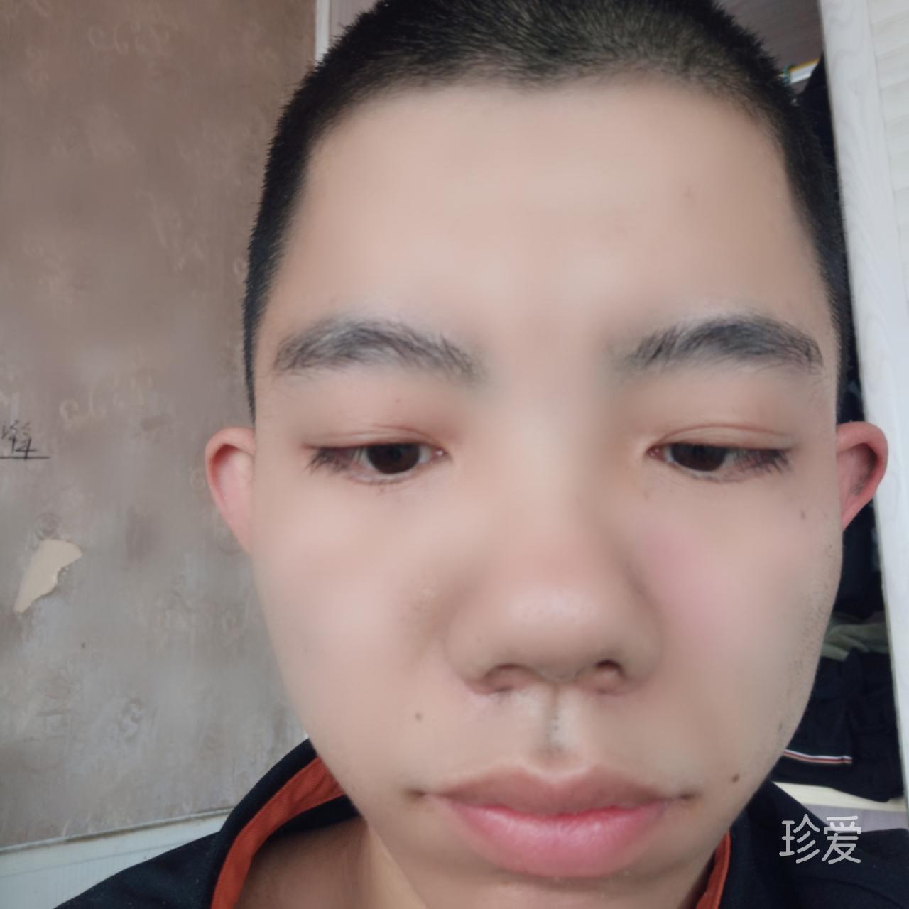 必须的