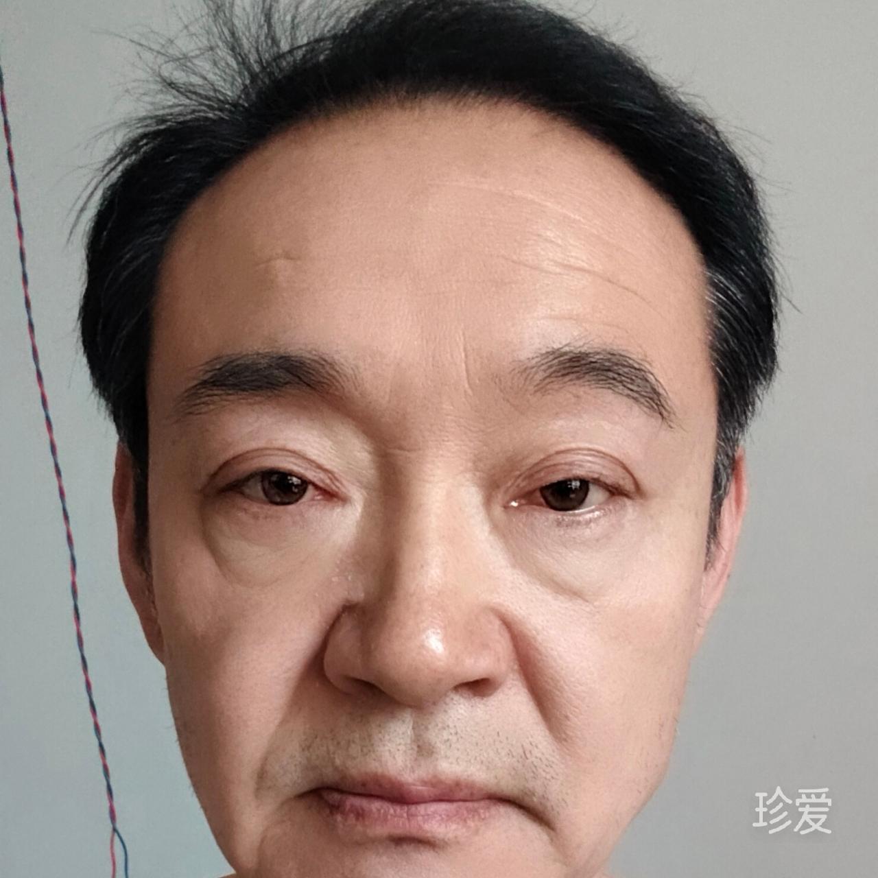 解独